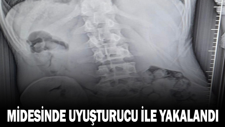 Midesinde 309 gram uyuşturucuyla yakalandı