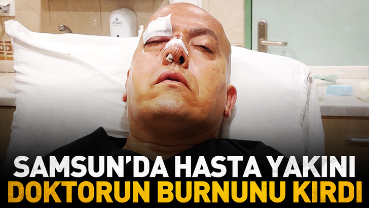 Samsun'da hasta yakını, yumrukladığı doktorun burnunu kırdı