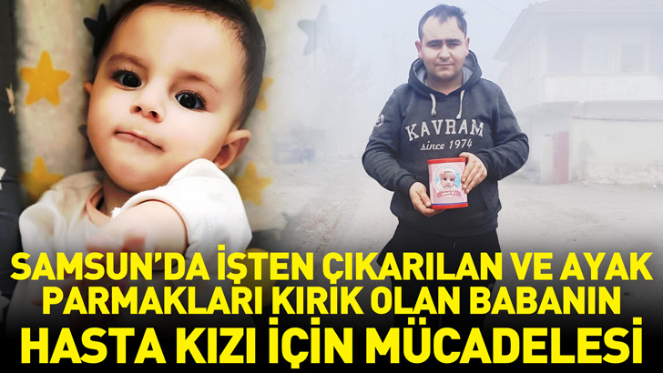 Samsun'da işten çıkarılan ve ayak parmakları kırık olan babanın hasta kızı için mücadelesi